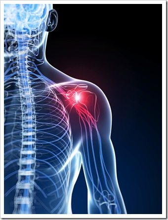Shoulder Pain Lakewood CO Rotator Cuff Syndrome