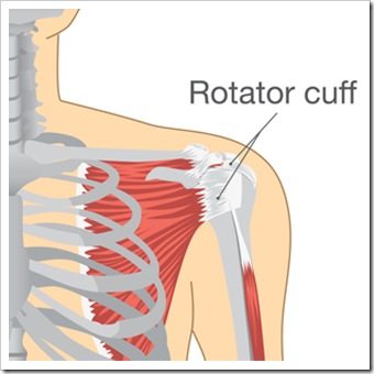 Shoulder Pain Lakewood CO Rotator Cuff Injury